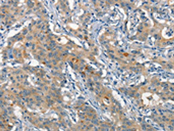 ALCAM Antibody (PACO18678)