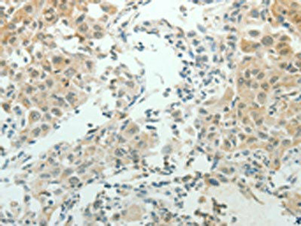 NDRG2 Antibody (PACO18730)