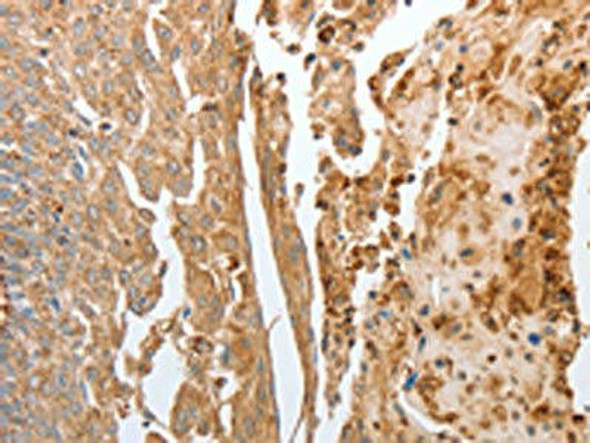 NPY1R Antibody (PACO18775)