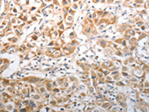 NQO1 Antibody (PACO18778)