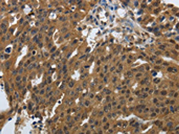 PDCD7 Antibody (PACO18817)