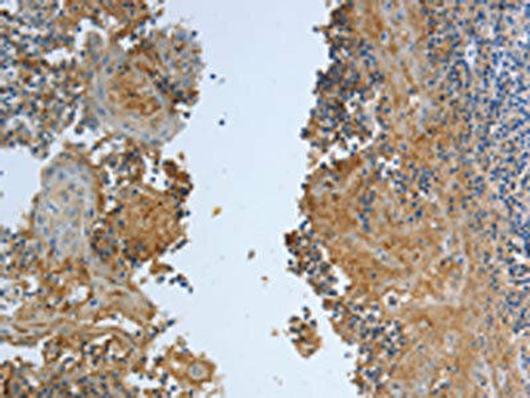 DLG4 Antibody (PACO18846)