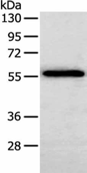 SERPINF2 Antibody (PACO19100)