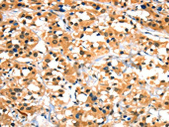 HTR3B Antibody (PACO19262)