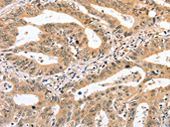 NCAM1 Antibody (PACO19435)