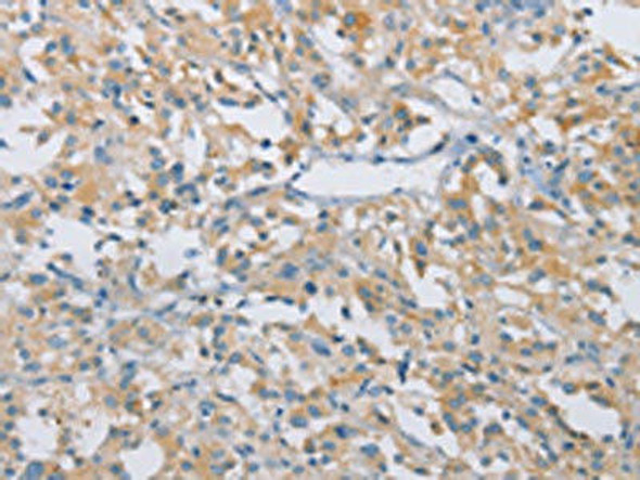 CDKN2A Antibody (PACO19459)
