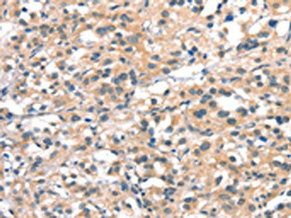 CYP2D6 Antibody (PACO19532)