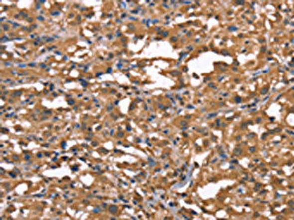 TDP2 Antibody (PACO19627)