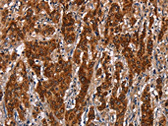 GCKR Antibody (PACO19709)