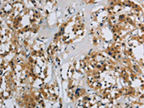 SYN1 Antibody (PACO19833)