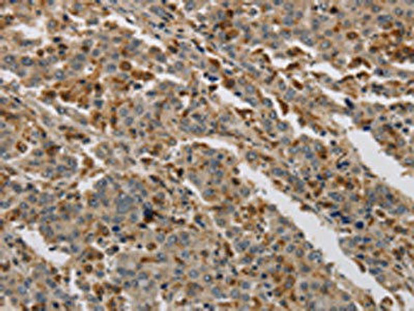 KDM4A Antibody (PACO19871)