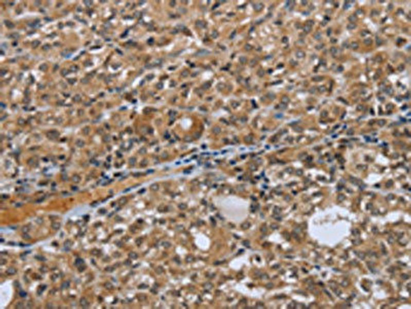 NRP2 Antibody (PACO20082)