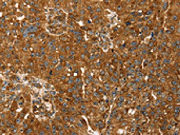 TBC1D1 Antibody (PACO20662)