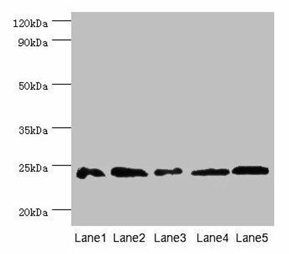 Gstp1 Antibody (PACO27229)