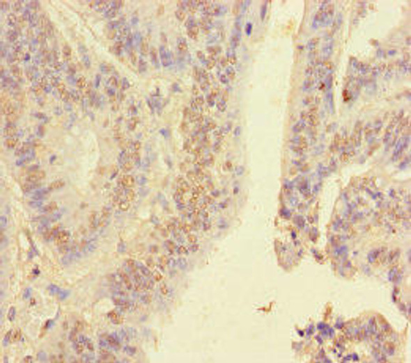 HNRNPA2B1 Antibody (PACO27405)