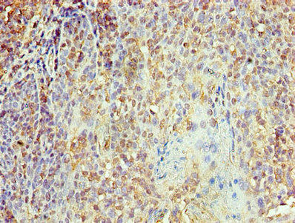 KPNA1 Antibody (PACO27841)