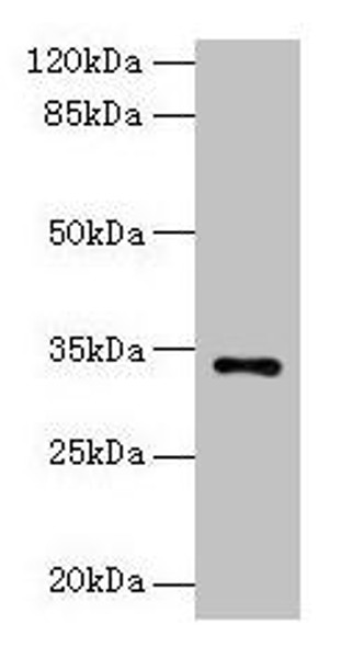 NAT2 Antibody (PACO28502)
