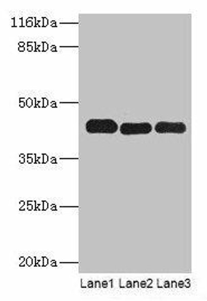 PPME1 Antibody (PACO29120)