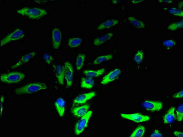 LYPLA2 Antibody (PACO31900)