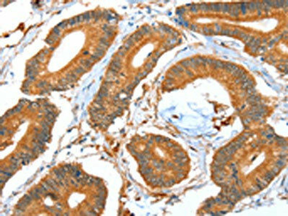 ACOT11 Antibody (PACO15262)