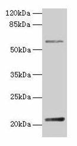 DUSP13 Antibody (PACO36634)