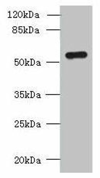 SLC38A2 Antibody (PACO39354)