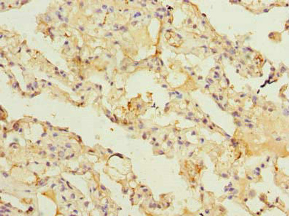 ARL11 Antibody (PACO39522)