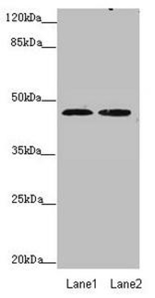 ZDHHC16 Antibody (PACO44600)