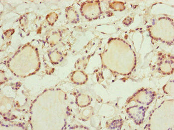 RNF11 Antibody (PACO45195)