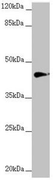 RNF13 Antibody (PACO45199)