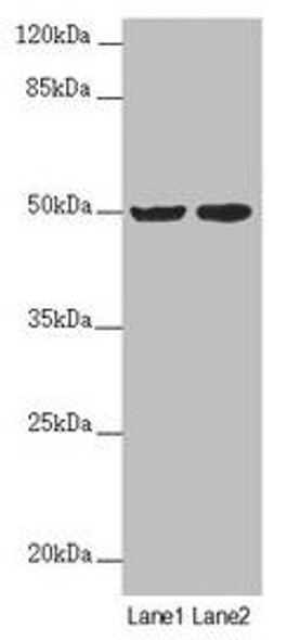 SLC39A7 Antibody (PACO45627)