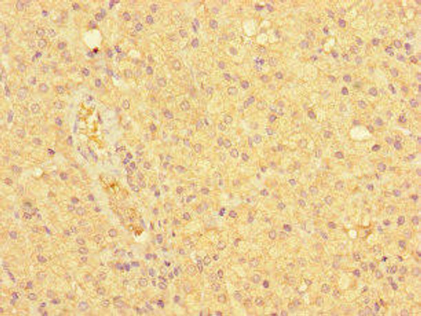 NDC80 Antibody (PACO46058)