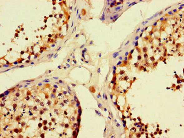 UNC13C Antibody (PACO48034)