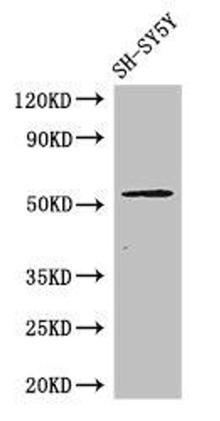 METTL14 Antibody (PACO48154)