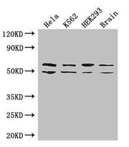 IGF2BP3 Antibody (PACO48366)