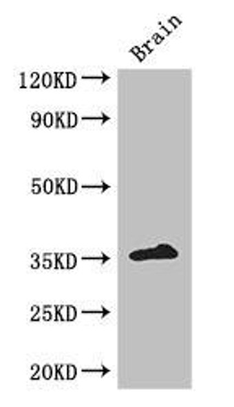 ZFP42 Antibody (PACO48722)