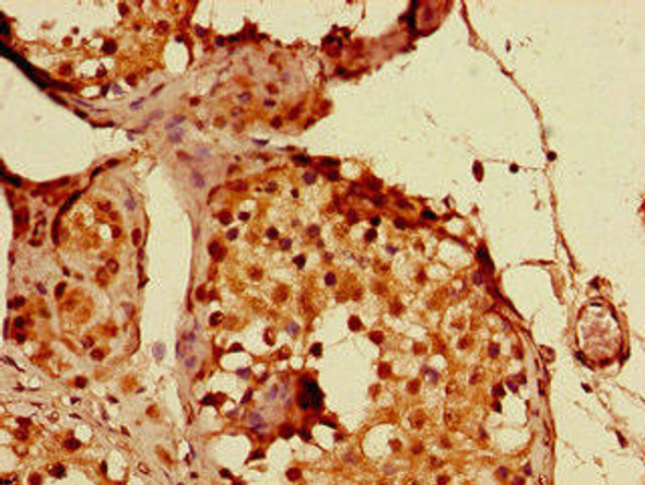 PPP1R13B Antibody (PACO49262)