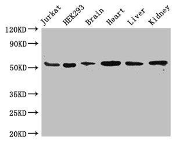 SLC18A2 Antibody (PACO50018)