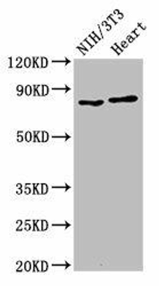 RPS6KA3 Antibody (PACO54982)
