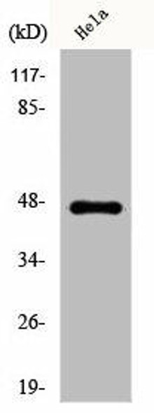 KRT20 Antibody (PACO00680)