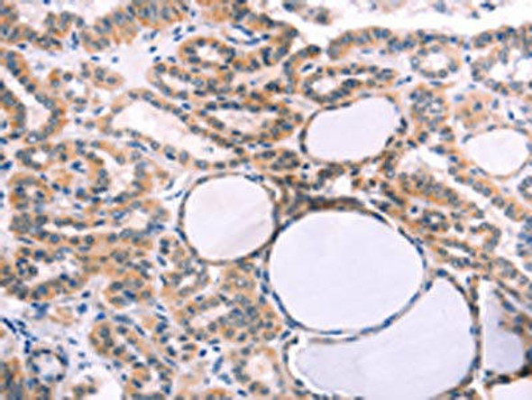IL1RL1 Antibody (PACO15198)
