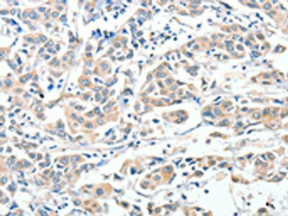ADAM10 Antibody (PACO15301)