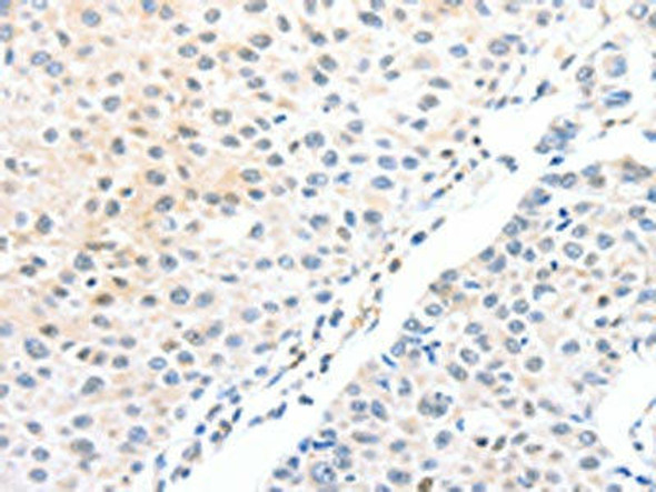 ADAM15 Antibody (PACO15305)