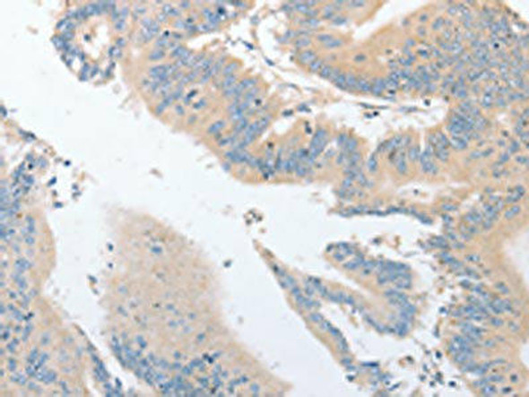 EPS15L1 Antibody (PACO15605)