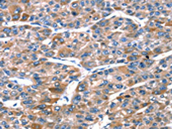 RPL11 Antibody (PACO17015)