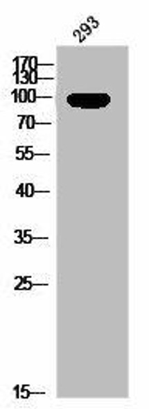 Phospho-PGR (S400) Antibody (PACO02971)