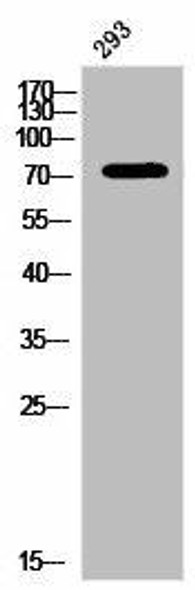 Phospho-PRKCA (Y657) Antibody (PACO02999)