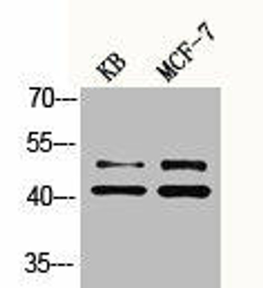 Phospho-MAPK1/MAPK3 (Y222/205) Antibody (PACO06169)