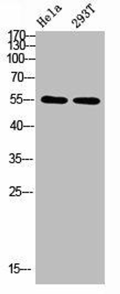 TUBA1A/TUBA1B/TUBA1C/TUBA3C/TUBA8/TUBA4A Antibody (PACO07481)