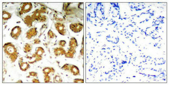 RELA (Ab-505) Antibody (PACO21389)